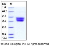 Sino Biological Recombinant Mouse CD157 Protein (His Tag), Quantity: Each