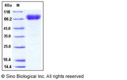 Sino Biological Mouse KIM-1 / TIM1 / HAVCR1 Protein (His & Fc Tag) 100ug,