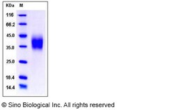 Sino Biological Recombinant Mouse CD16/FCGR3/Fc gamma RIII Protein (ECD,