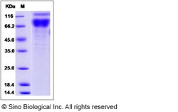 Sino Biological Mouse IL17RA / IL17R / CD217 Protein (Fc Tag) 100ug, Quantity: