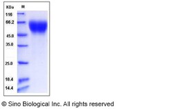 Sino Biological Recombinant Mouse IL-17RA Protein (His Tag), Quantity: