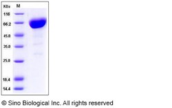 Sino Biological Recombinant Mouse CD147/Basigin/EMMPRIN Protein (His &