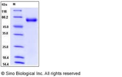 Sino Biological Mouse Angiotensinogen / SerpinA8 / AGT Protein (His Tag)