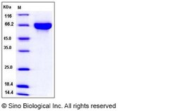 Sino Biological Mouse KIRREL3 / NEPH2 Protein (His Tag) 100ug, Quantity: