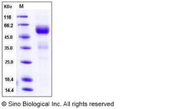 Sino Biological Recombinant Mouse Betacellulin Protein (His & hFc Tag),