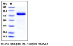 Sino Biological Mouse Cathepsin A / CTSA Protein (His Tag) 50ug, Quantity: