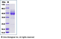 Sino Biological Mouse BAFFR / TNFRSF13C / CD268 Protein (Fc Tag) 200ug,