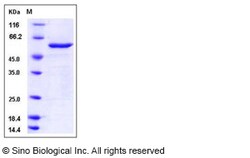 Sino Biological Mouse ITK Kinase Protein (aa 351-619, His & GST Tag) 50ug,