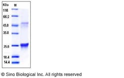 Sino Biological Recombinant Mouse GLO1 Protein (His Tag), Quantity: Each