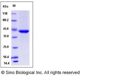 Sino Biological Mouse Serpinb6b Protein (His Tag) 50ug, Quantity: Each