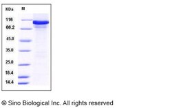 Sino Biological Recombinant Mouse alanyl-tRNA synthetase Protein (His Tag),