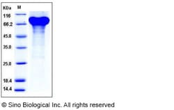 Sino Biological Recombinant Mouse Progranulin Protein (His Tag), Quantity: