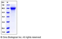 Sino Biological Recombinant Mouse THSD1 Protein (His Tag), Quantity: Each
