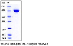 Sino Biological Mouse Endoglin / CD105 / ENG Protein (His Tag) 100ug, Quantity: