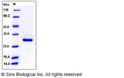 Sino Biological Recombinant Mouse C-Reactive Protein Protein (His Tag),