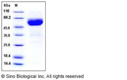 Sino Biological Recombinant Mouse DR5/TRAIL R2 Protein (His & hFc Tag),