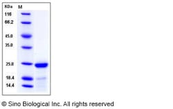 Sino Biological Mouse FGF21 / Fibroblast Growth Factor 21 Protein (His