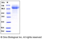Sino Biological Recombinant Mouse CD36 Protein (His Tag), HPLC-verified,