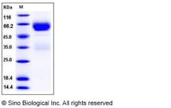 Sino Biological Recombinant Mouse Serpin A11 Protein (His Tag), Quantity: