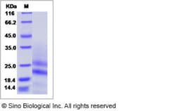 Sino Biological Recombinant Mouse PDGF-A Protein (His Tag), Quantity: Each