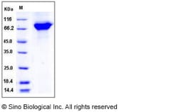 Sino Biological Recombinant Mouse Periostin Protein (His Tag), Quantity: