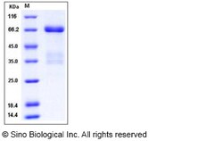 Sino Biological Mouse PRLR / Prolactin Receptor Protein (His & Fc Tag)