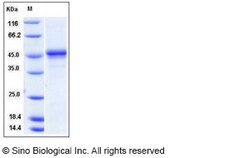 Sino Biological Recombinant Mouse PDGF-C Protein (hFc Tag), Quantity: Each