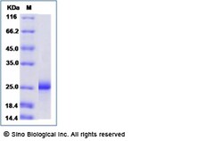 Sino Biological Recombinant Mouse PDGF-C Protein (His Tag), Quantity: Each