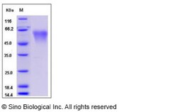 Sino Biological Recombinant Mouse CD55/DAF Protein (His Tag), Quantity:
