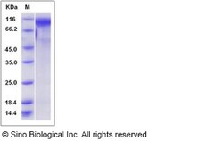 Sino Biological Recombinant Mouse Osteoactivin/GPNMB Protein (His Tag),