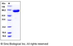 Sino Biological Recombinant Mouse EphB1 Protein (His Tag), HPLC-verified,