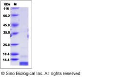 Sino Biological Recombinant Mouse S100A4 Protein, Quantity: Each of 1