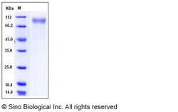 Sino Biological Recombinant Mouse RP105/CD180 Protein (His Tag), HPLC-verified,