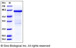 Sino Biological Recombinant Mouse MMP-8 Protein, Quantity: Each of 1