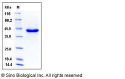 Sino Biological Recombinant Mouse SPARC Protein (His Tag), HPLC-verified,