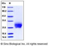 Sino Biological Mouse CTLA4 / CD152 Protein (ECD,His Tag) 100ug, Quantity: