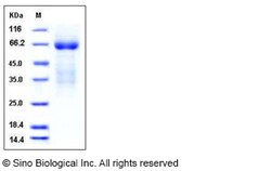 Sino Biological Mouse LY9 / CD229 / SLAMF3 Protein (His Tag) 100ug, Quantity: