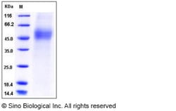 Sino Biological Recombinant Mouse CD19 Protein (ECD, His Tag), Quantity: