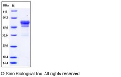 Sino Biological Mouse CD99 / PILR1 Protein (Fc Tag) 100ug, Quantity: Each