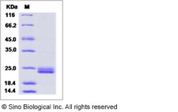 Sino Biological Mouse IFN-alpha / IFNA1 / IFN Protein (His Tag) 100ug,