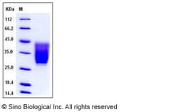 Sino Biological Recombinant Mouse CD99L2 Protein (His Tag), Quantity: Each