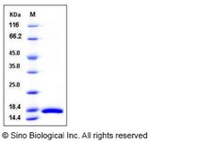 Sino Biological Recombinant Mouse CRABP2 Protein (His Tag), HPLC-verified,