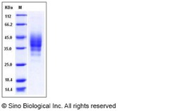 Sino Biological Mouse CD2 / LY37 Protein (His Tag) 50ug, Quantity: Each