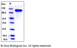 Sino Biological Mouse DDR2 Kinase / CD167b Protein (His Tag) 100ug, Quantity: