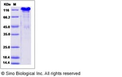 Sino Biological Mouse SPARCL1 / SPARC-like 1 Protein (His Tag) 100ug, Quantity: