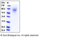 Sino Biological Recombinant Mouse C4.4A/LYPD3 Protein (His Tag), Quantity: