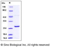 Sino Biological Recombinant Mouse Peroxiredoxin 1 Protein (His Tag), Quantity: