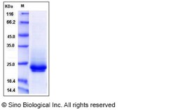 Sino Biological Recombinant Mouse Frizzled-10 Protein (His Tag), Quantity: