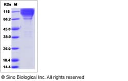 Sino Biological Recombinant Mouse CEACAM-1/CD66a Protein (ECD, hFc Tag),