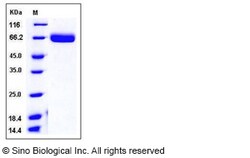 Sino Biological Recombinant Mouse EphA4 Protein (His Tag), Quantity: Each